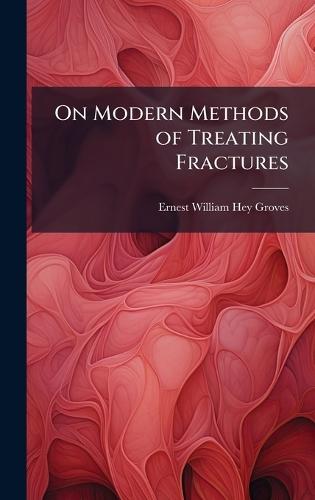 On Modern Methods of Treating Fractures
