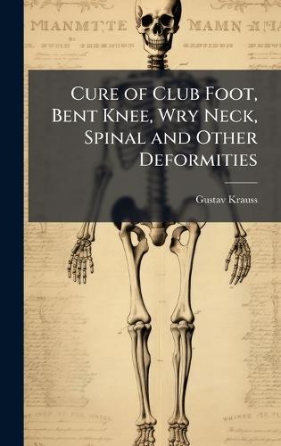 Cure of Club Foot, Bent Knee, Wry Neck, Spinal and Other Deformities