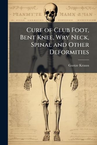 Cure of Club Foot, Bent Knee, Wry Neck, Spinal and Other Deformities