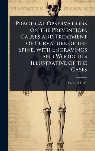 Practical Observations on the Prevention, Causes and Treatment of Curvature of the Spine, With Engravings and Woodcuts Illustrative of the Cases