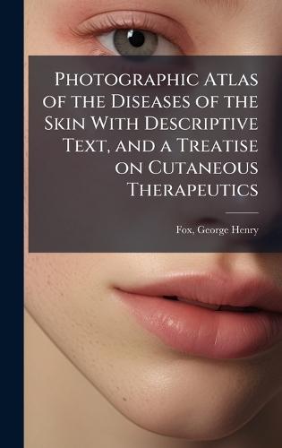 Photographic Atlas of the Diseases of the Skin With Descriptive Text, and a Treatise on Cutaneous Therapeutics