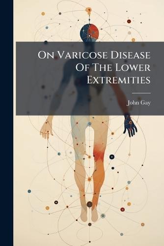 On Varicose Disease Of The Lower Extremities