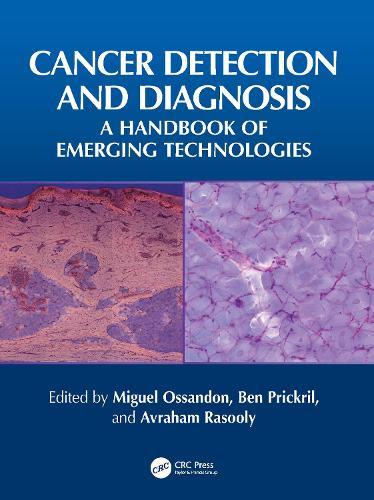 Cancer Detection and Diagnosis: A Handbook of Emerging Technologies