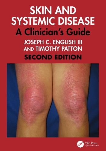 Skin and Systemic Disease: A Clinician's Guide