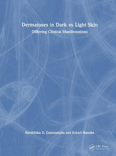 Dermatoses in Dark Vs Light Skin: Differing Clinical Manifestations