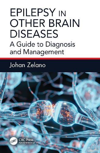 Epilepsy in Other Brain Diseases: A Guide to Diagnosis and Management