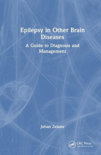 Epilepsy in Other Brain Diseases: A Guide to Diagnosis and Management