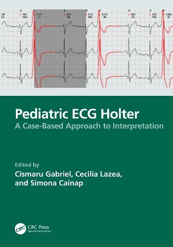 Pediatric ECG Holter: A Case-Based Approach to Interpretation