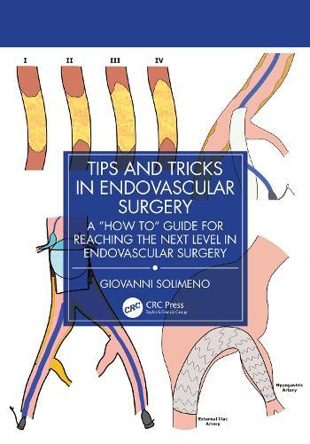 Tips and Tricks in Endovascular Surgery: A ""How to"" Guide for reaching the next Level in Endovascular Surgery