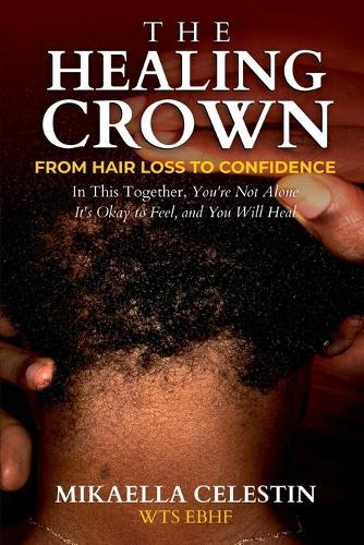The Healing Crown: From Hair Loss to Confidence