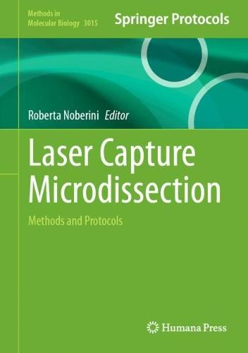 Laser Capture Microdissection: Methods and Protocols