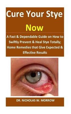 Cure Your Stye Now: A Fast & Dependable Guide on How to Swiftly Prevent & Heal Stye Totally; Home Remedies That Give Expected & Effective Results