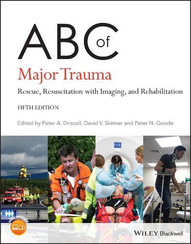 ABC of Major Trauma: Rescue, Resuscitation with Imaging, and Rehabilitation