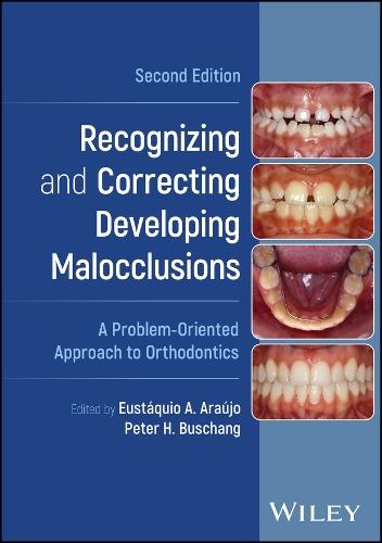 Recognizing and Correcting Developing Malocclusions: A Problem-Oriented Approach to Orthodontics