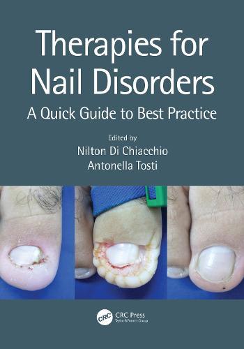 Therapies for Nail Disorders: A Quick Guide to Best Practice