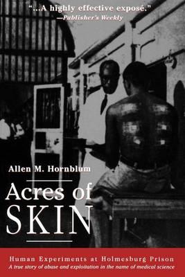 Acres of Skin: Human Experiments at Holmesburg Prison, a True Story of Abuse and Exploitation in the Name of Medical Science