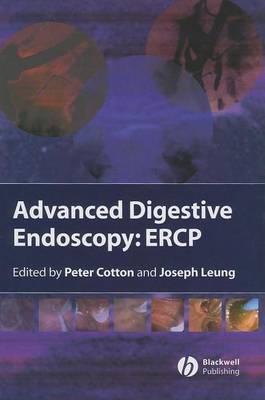 Advanced Digestive Endoscopy