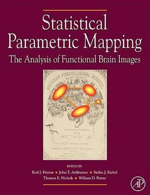 Statistical Parametric Mapping: The Analysis of Functional Brain Images: The Analysis of Functional Brain Images