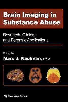 Brain Imaging in Substance Abuse. Forensic Science and Medicine.
