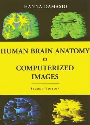 Human Brain Anatomy in Computerized Images