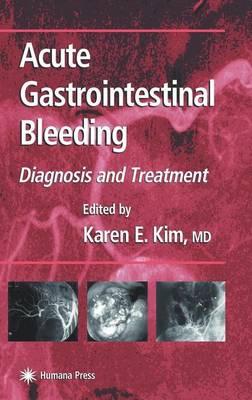 Acute Gastrointestinal Bleeding: Diagnosis and Treatment. Clinical Gastroenterology.
