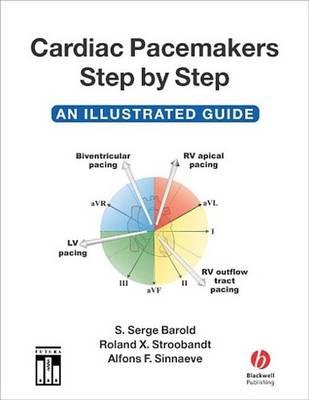 Cardiac Pacemakers Step-By-Step: An Illustrated Guide