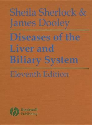 Diseases of the Liver and Biliary System