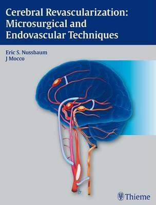 Cerebral Revascularization: Microsurgical and Endovascular Techniques