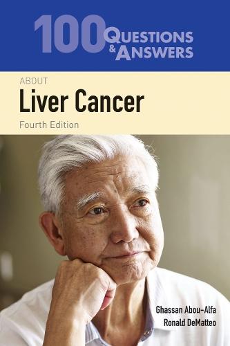 100 Questions & Answers About Liver Cancer