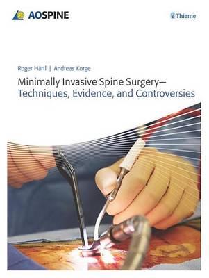 Minimally Invasive Spine Surgery