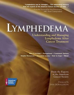 Lymphedema: Understanding and Managing Lymphedema After Cancer Treatment