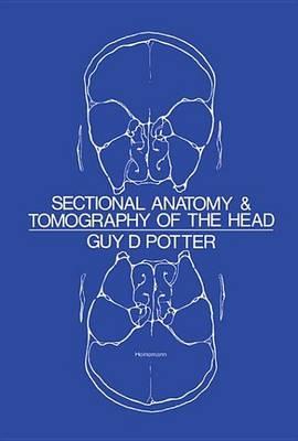 Sectional Anatomy and Tomography of the Head