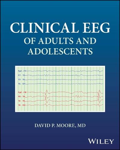 Clinical EEG of Adults and Adolescents