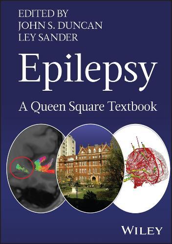 Epilepsy: A Queen Square Textbook
