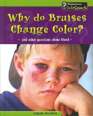 Why Do Bruises Change Color?: And Other Questions about Blood