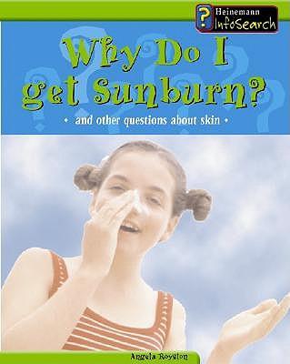 Why Do I Get a Sunburn?: And Other Questions about Skin