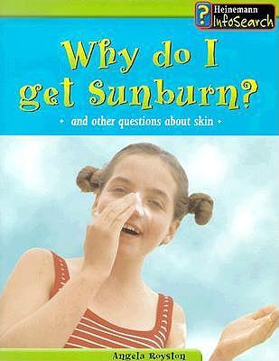 Why Do I Get a Sunburn?: And Other Questions about Skin
