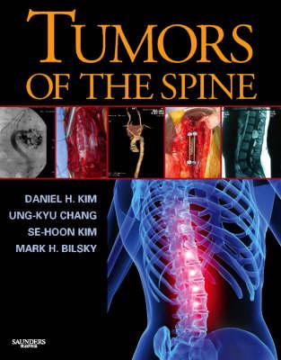 Tumors of the Spine