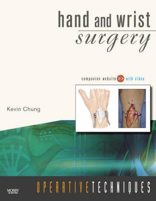 Hand and Wrist Surgery