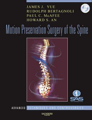 Motion Preservation Surgery of the Spine: Advanced Techniques and Controversies
