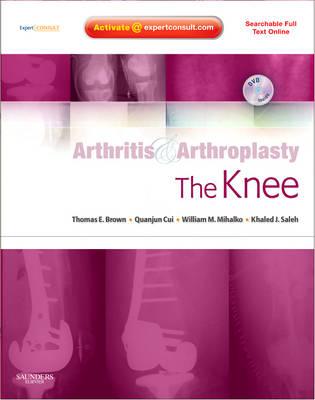 Arthritis and Arthroplasty: The Knee: Expert Consult - Online, Print and DVD