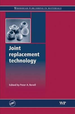 Joint Replacement Technology