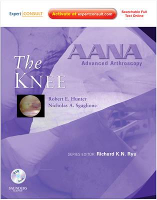 AANA Advanced Arthroscopy: The Knee: Expert Consult: Online, Print and DVD