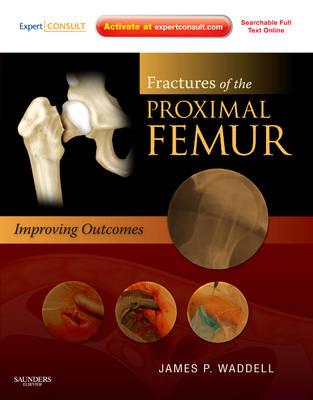 Fractures of the Proximal Femur: Improving Outcomes: Expert Consult: Online and Print