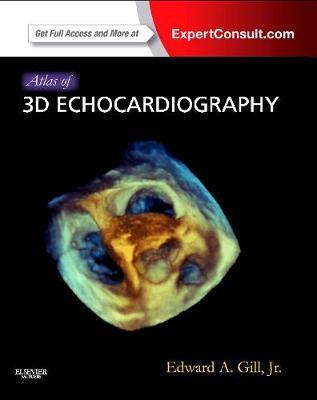 Atlas of 3D Echocardiography: Expert Consult - Online and Print