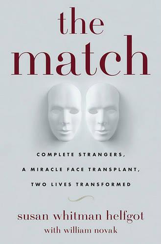 The Match: Complete Strangers, a Miracle Face Transplant, Two Lives Transformed