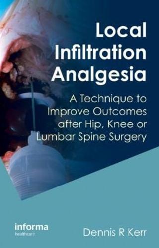 Local Infiltration Analgesia: A Technique to Improve Outcomes after Hip, Knee or Lumbar Spine Surgery