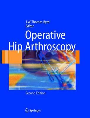 Operative Hip Arthroscopy