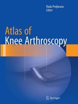 Atlas of Knee Arthroscopy
