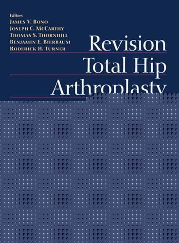 Revision Total Hip Arthroplasty